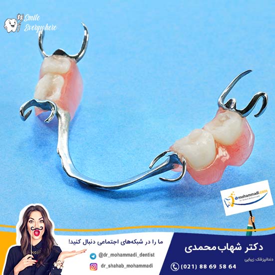کدام روش برای شما مناسب تر است؟ ایمپلنت دندان ثابت یا دندان مصنوعی سنتی - کلینیک دندانپزشکی دکتر شهاب محمدی